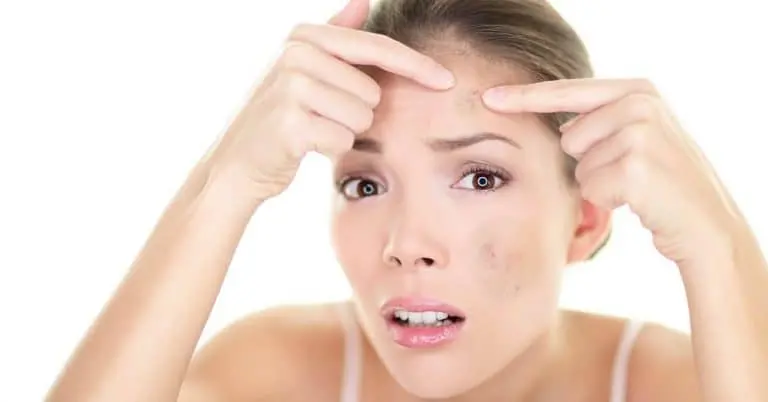 How To Remove Dark Spots Naturally 768x402